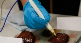 Un bisturí inteligente es capaz de ‘oler’ el cáncer
