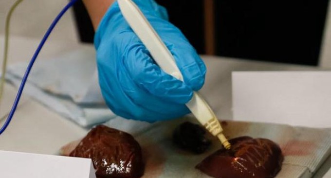 Un bisturí inteligente es capaz de ‘oler’ el cáncer