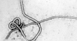 Una semana de anuncios ambiguos sobre la cura del Ébola